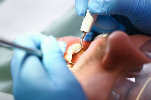 Best After-Hours Emergency Dentist in Checotah, OK