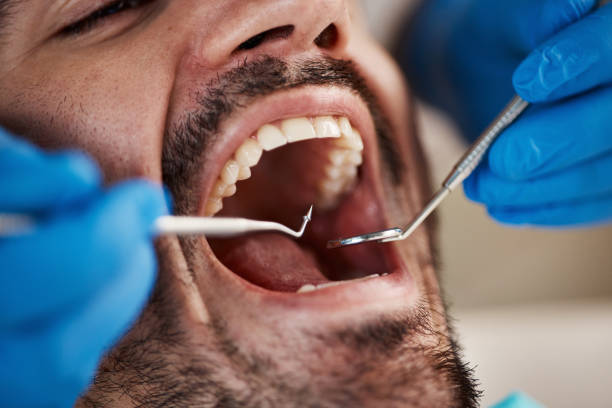Best Emergency Broken Tooth Repair in Checotah, OK