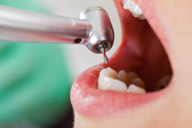 Best Emergency Treatment for Toothache in Checotah, OK
